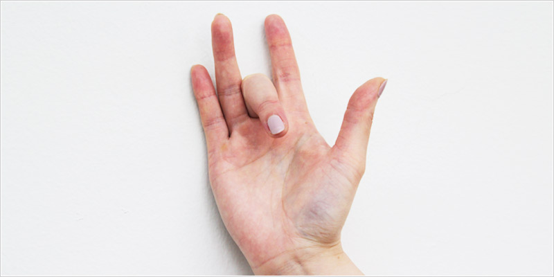 中指 テーピング ばね 指 ばね指の注射は何回まで出来る？